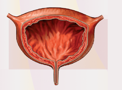Unzeeche vu Cystitis