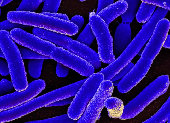 E. coli provozéiert meeschtens d’Entwécklung vu Cystitis bei Fraen